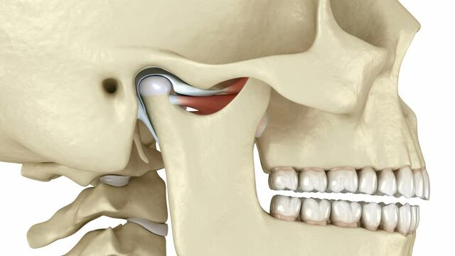 Temporomandibular joints and dislocated articular disc. Medically accurate 3D animation
