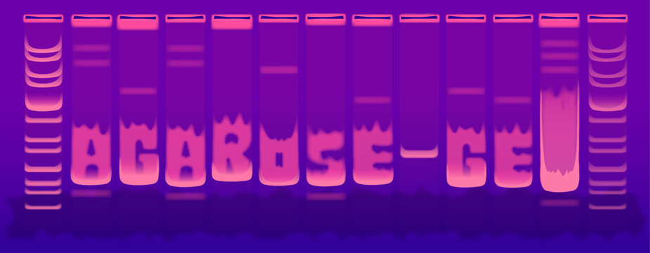 DNA Electrophoresis Agarose Gel Under Uv Light