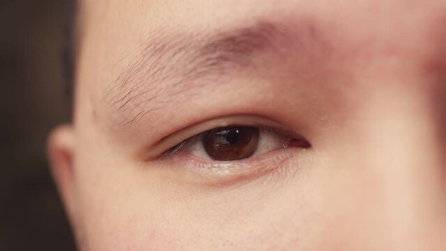 Close-up of the eye of a man of Eastern appearance with a nervous TIC. The man's eye twitches with a nervous TIC