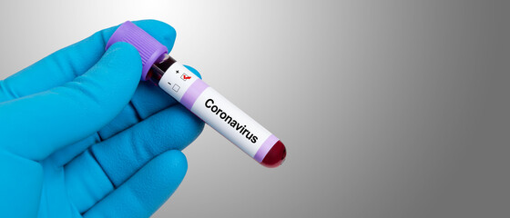 Obraz premium Coronavirus 2019-nCoV Blood Sample.
