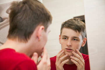 Close up of young attractive man with problematic skin and scars from acne looks in the mirror in the bathroom