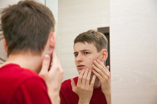 Close up of young attractive man with problematic skin and scars from acne looks in the mirror in the bathroom