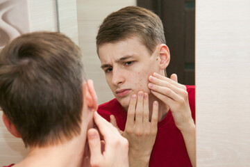 Close up of young attractive man with problematic skin and scars from acne looks in the mirror in...