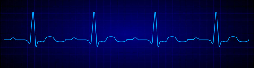 Heartbeat line. Blue electrocardiogram. Vector pulse line. Medical cardiogram on grid background.