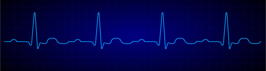 Heartbeat line. Blue electrocardiogram. Vector pulse line. Medical cardiogram on grid background.