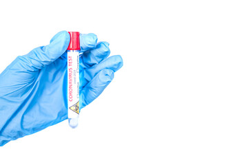 Hand holds a test tube containing a blood sample, test tube with blood for Covid-19 (coronavirus) analyzing