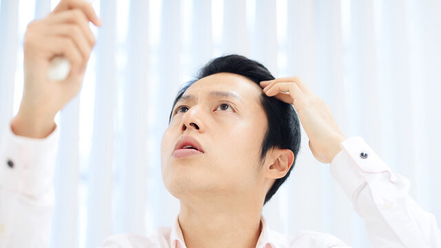 生え際を気にする男性