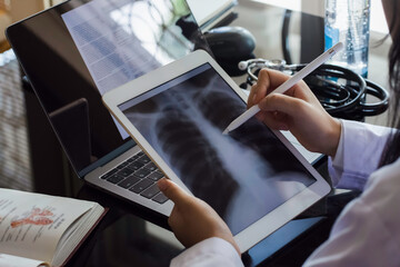 Female doctor hand holding digital tablet with chest x-ray film (CXR ) on screen and work on laptop computer at the office in clinic or hospital. Medical and health care concept. - Powered by Adobe