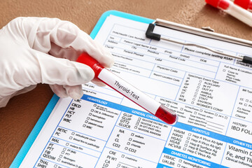 Hand of doctor with blood sample in tube and laboratory test form, closeup. Concept of thyroid disease