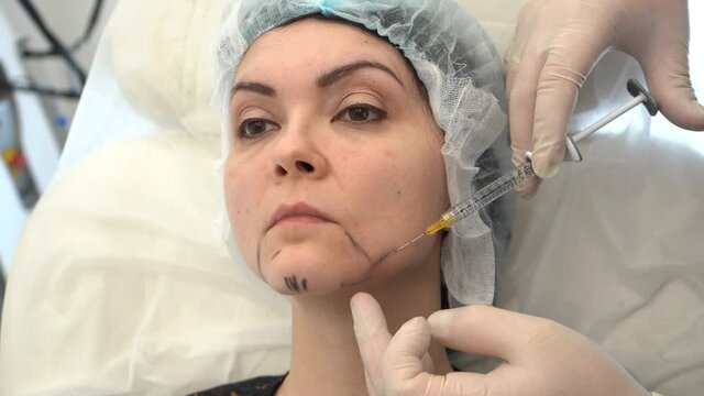 The doctor in white gloves makes a correction of the shape of the chin