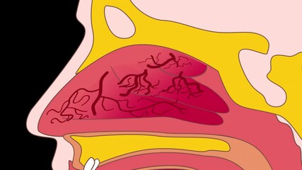 Nasal congestion HD alpha channel	