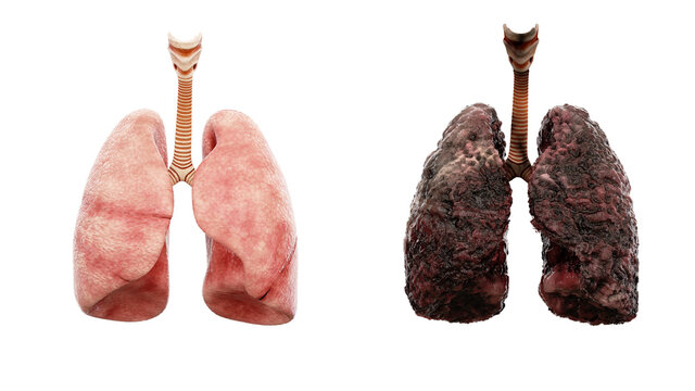 healthy lungs and disease lungs on white isolate. Autopsy medical concept. Cancer and smoking problem. 3d rendering