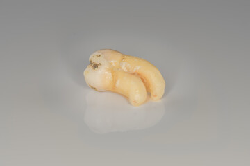 A closeup of a sectioning right lower third molar with curved root. (Adult tooth number 48)