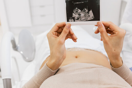 Cropped unrecognizable pregnant female inspecting sonogram picture while lying on bed in ward of modern fertility clinic