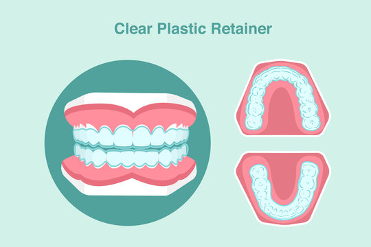 clear plastic retainer