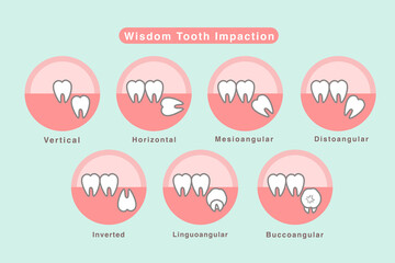 Wisdom tooth  illustration Vector.