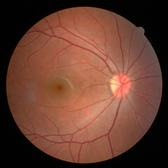 retinal image
