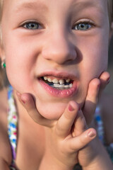 Little girl with orthodontics appliance and crooked teeth. Wobbly tooth.