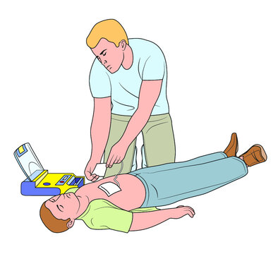 Poniendo parches del desfibrilador - Reanimaci&oacute;n cardiopulmonar