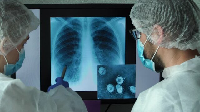 Team of doctors at computer monitor in clinic discuss lung x-ray with pneumonia and photo of virus of several times enlarged under microscope. COVID-19