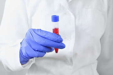 Laboratory doctor with  test tube of blood tests in hands on a white background.
