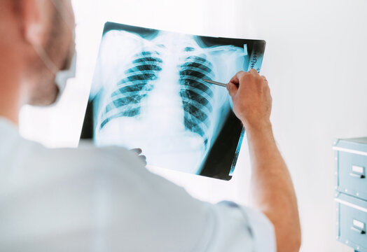 Male doctor examining the patient chest x-ray film lungs scan at radiology department in hospital.Covid-19 scan body xray test detection for covid worldwide virus epidemic spread concept.