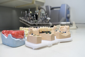 zirconia dental crowns on dental models