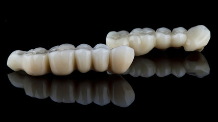 dental prostheses - bridges for restoration of the chewing part of the patient's jaw, shot on a black background with reflection