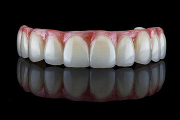beautiful composition of the dental prosthesis of the upper jaw with a pink gum, shot on black glass with reflection © Dental Pro Content