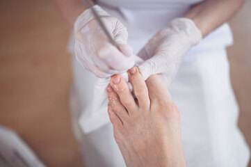Professional medical pedicure procedure close up using double nail instrument. Patient visiting chiropodist podiatrist. Foot treatment in SPA salon. Podiatry clinic. Pedicurist hands in white gloves.