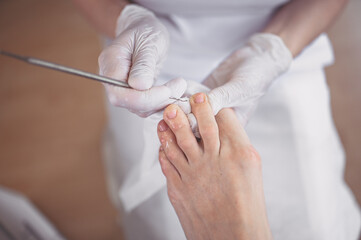Professional medical pedicure procedure close up using double nail instrument. Patient visiting chiropodist podiatrist. Foot treatment in SPA salon. Podiatry clinic. Pedicurist hands in white gloves.