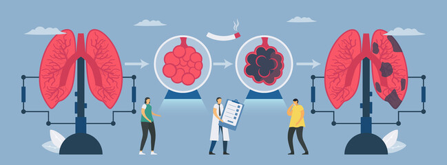 Chronic obstructive pulmonary disease or COPD. Transformation from normal lung to bad lung. Symptoms are breathing problems and poor airflow. Vector illustration in flat design.