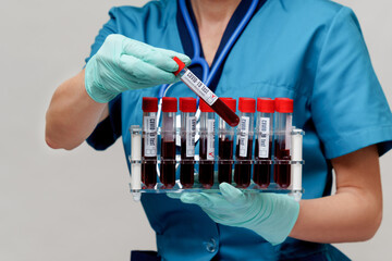 medical doctor nurse woman wearing protective mask and gloves - holding rack with virus blood tests