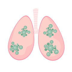 Human lungs infected with Coronavirus cells flat cartoon illustration. Covid-19 causing pneumonia of lungs. Stop and fight the global pandemic of Coronavirus outbreak vector concept.