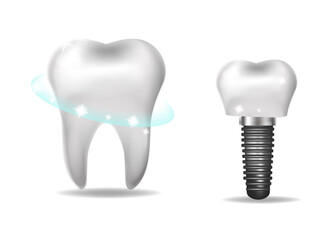 Dental implants, prosthetics 3D realistic style. Dentistry, healthy teeth concept. Vector illustration