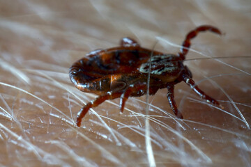 Macro close up of crawling parasitic Dermacentor reticulatus crawling on human skin. Also known as the ornate cow tick, ornate dog tick, meadow tick, and marsh tick. 