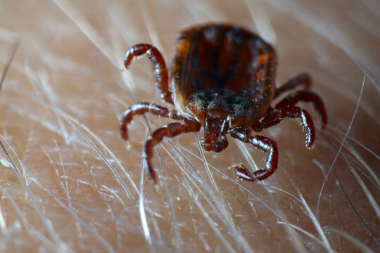 Macro close up of crawling parasitic Dermacentor reticulatus crawling on human skin. Also known as the ornate cow tick, ornate dog tick, meadow tick, and marsh tick. 