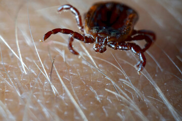 Macro close up of crawling parasitic Dermacentor reticulatus crawling on human skin. Also known as the ornate cow tick, ornate dog tick, meadow tick, and marsh tick. 