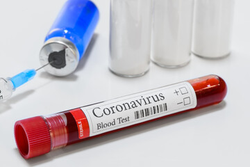 COVID-19 laboratory test tube and laboratory sample of blood testing for diagnosis coronavirus infection medicines and pharmacology isolated