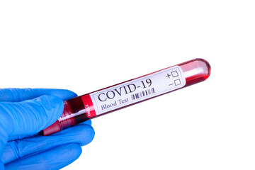 Obraz premium COVID-19 test and laboratory sample of blood testing for diagnosis coronavirus infection in the hands of laboratory assistant isolated on white background and space for ads concept
