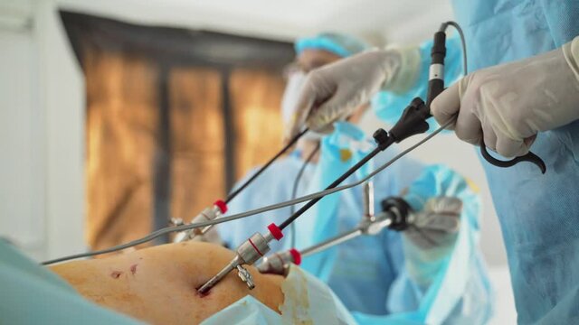 Medical team performing operation. Medical team of surgeons in hospital doing minimal invasive surgical interventions