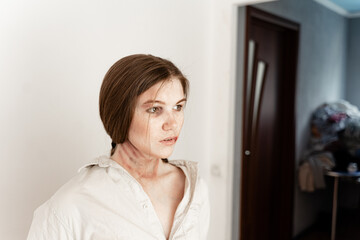 close-up portrait of a girl who has become a victim of domestic violence, stands on a white background, looks at the camera, a girl with freckles