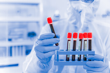 Male doctor in protective suit wear mask and glasses with protect gloves and holding blood sampling tube