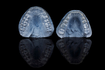 special dental caps for aligning the upper and lower jaw, shot on a black background with reflection