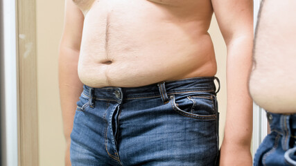 Big fat male belly hanging over small jeans. Concept of male overweight, weight loss and dieting