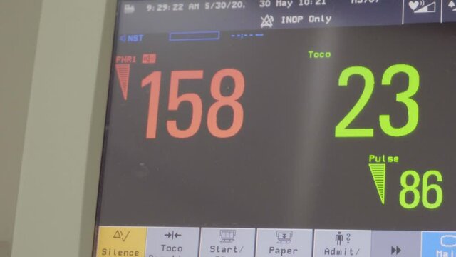 Monitor of diagram Pregnant woman with electrocardiograph check up for her baby. Fetal heart monitoring. Diagnostic, healthcare, medical service