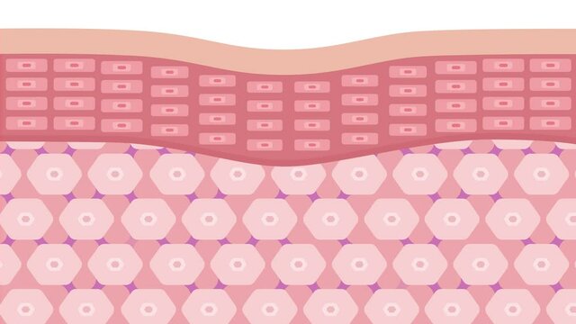 collagen loss in younger skin and aging skin , 3 type collagen skin version graphic animation