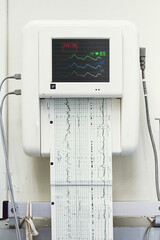 Close up of a fetal monitor baby heartbeats