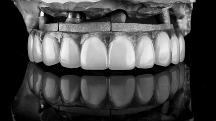 excellent composition of the upper jaw prosthesis on the model and a special metal beam, shot with reflection in black and white style © Dental Pro Content