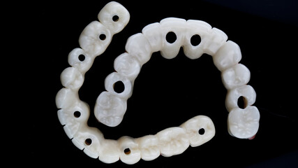 composition of dental prostheses for the lower and upper jaws, top view on a black background © Dental Pro Content